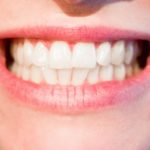 Nowoczesna technologia używana w salonach stomatologii estetycznej może sprawić, że odbierzemy piękny uśmiech.